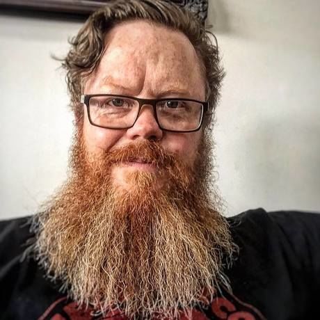 Alister beard no trim