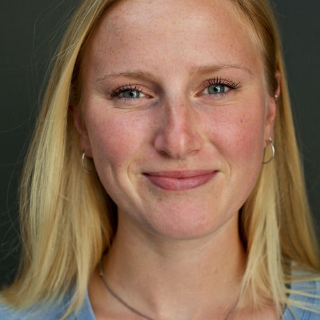 23jan17   anna s face